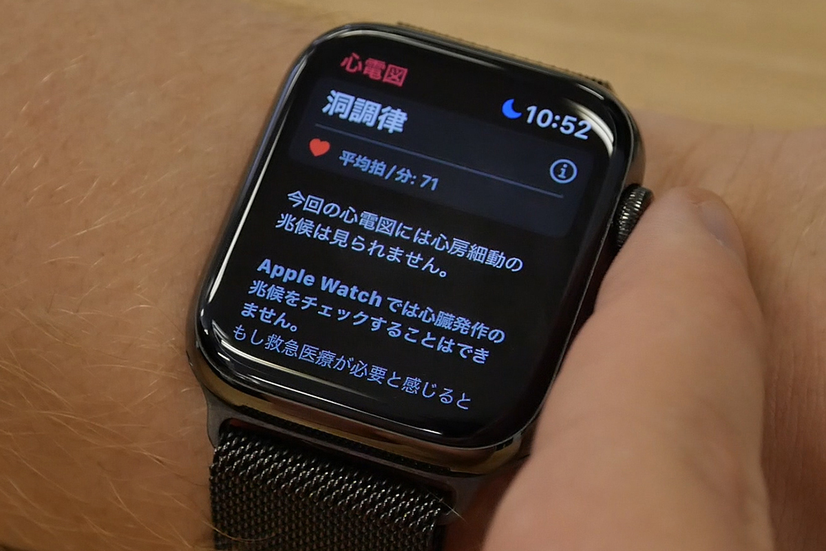Apple Watchで心房細動予兆検知 通知 東京海上が実証実験 Impress Watch