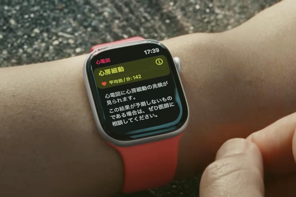Apple Watchに救われた50歳の体験 心房細動を見逃さないために 
